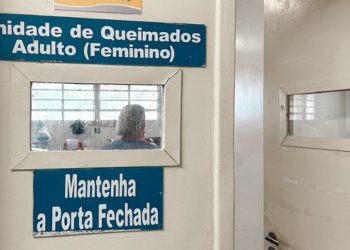 Hospital da Restauração alerta para prevenção de queimaduras durante festejos juninos