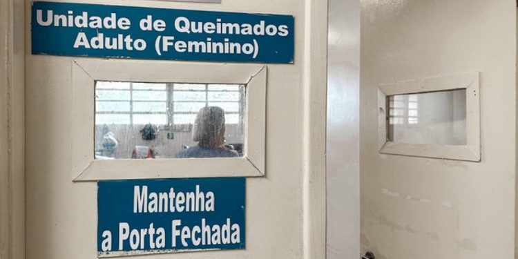 Hospital da Restauração alerta para prevenção de queimaduras durante festejos juninos